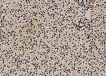 DDX21 Antibody in Immunohistochemistry (Paraffin) (IHC (P))