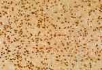 DDX21 Antibody in Immunohistochemistry (Paraffin) (IHC (P))