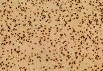 DDX21 Antibody in Immunohistochemistry (Paraffin) (IHC (P))