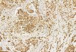 DDX21 Antibody in Immunohistochemistry (Paraffin) (IHC (P))