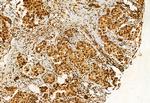 DDX21 Antibody in Immunohistochemistry (Paraffin) (IHC (P))