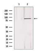 DDX21 Antibody in Western Blot (WB)