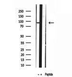 DDX21 Antibody in Western Blot (WB)