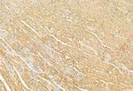 GDI2 Antibody in Immunohistochemistry (Paraffin) (IHC (P))