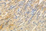 GDI2 Antibody in Immunohistochemistry (Paraffin) (IHC (P))