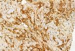 GDI2 Antibody in Immunohistochemistry (Paraffin) (IHC (P))