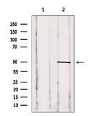 GDI2 Antibody in Western Blot (WB)