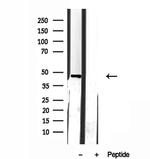 GDI2 Antibody in Western Blot (WB)