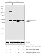 Phospho-GSK3B (Ser9) Antibody in Western Blot (WB)