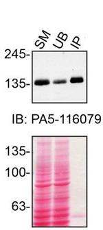 TSC1 Antibody in Immunoprecipitation (IP)