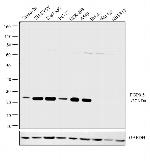 PGP9.5 Antibody in Western Blot (WB)