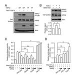 Phospho-HIPK2 (Tyr361) Antibody in Western Blot (WB)