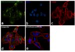 MMP14 Antibody in Immunocytochemistry (ICC/IF)