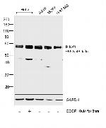 PINK1 Antibody in Western Blot (WB)