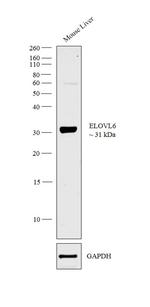 ELOVL6 Antibody in Western Blot (WB)