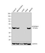 SERPINH1 Antibody in Western Blot (WB)