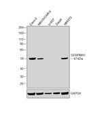 SERPINH1 Antibody in Western Blot (WB)