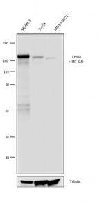 ErbB2 (HER-2) Antibody