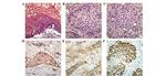 VEGF Receptor 2 Antibody in Immunohistochemistry (Paraffin) (IHC (P))