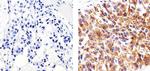 MUC1 Antibody in Immunohistochemistry (Paraffin) (IHC (P))