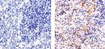 VEGF Receptor 3 Antibody in Immunohistochemistry (Paraffin) (IHC (P))