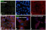 RRM1 Antibody