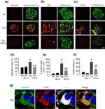 Ubiquitin Antibody in Immunohistochemistry (IHC)