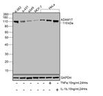 ADAM17 Antibody in Western Blot (WB)