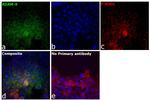 ADAM9 Antibody in Immunocytochemistry (ICC/IF)