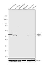 ZIPK Antibody in Western Blot (WB)