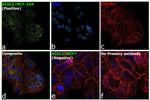 ACSL1 Antibody