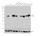 ACSL1 Antibody in Western Blot (WB)