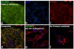 IGF2BP1 Antibody in Immunocytochemistry (ICC/IF)