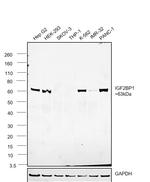 IGF2BP1 Antibody in Western Blot (WB)