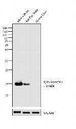 alpha Synuclein Antibody