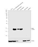 FABP4 Antibody in Western Blot (WB)