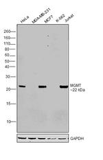 MGMT Antibody in Western Blot (WB)