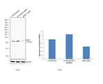 MGMT Antibody in Western Blot (WB)