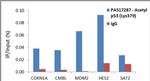 Acetyl-p53 (Lys379) Antibody