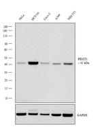 PRMT1 Antibody in Western Blot (WB)