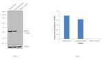 PRMT1 Antibody in Western Blot (WB)