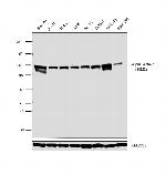 alpha Actinin 1 Antibody