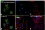 ATGL Antibody in Immunocytochemistry (ICC/IF)