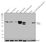 ATGL Antibody in Western Blot (WB)