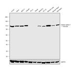 Catenin alpha-1 Antibody in Western Blot (WB)