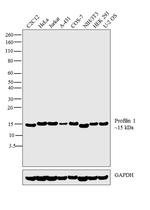 Profilin 1 Antibody in Western Blot (WB)