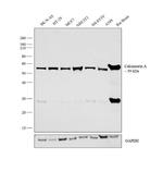 Calcineurin A Antibody in Western Blot (WB)