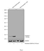 Caveolin 1 Antibody in Western Blot (WB)