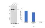 c-Cbl Antibody in Western Blot (WB)