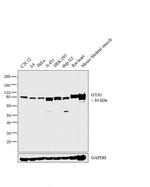 GYS1 Antibody in Western Blot (WB)